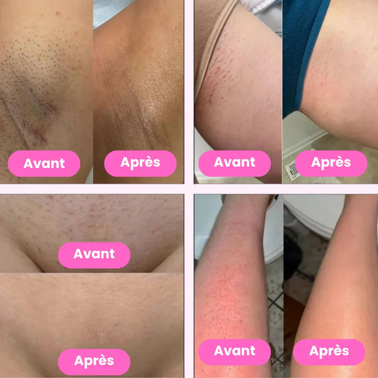 Épilateur Électrique Nusikana