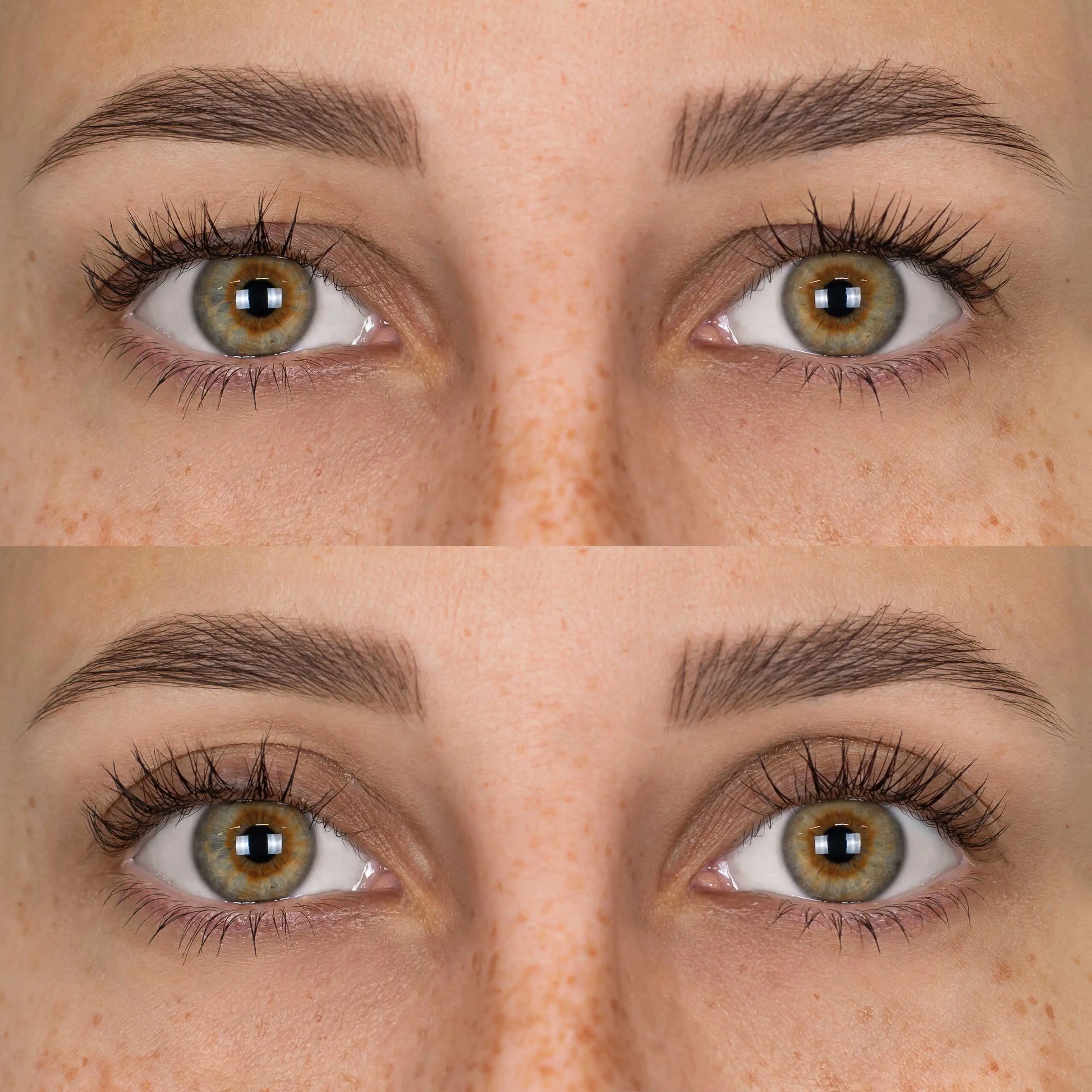 Patchs Lift Paupières Nusikana