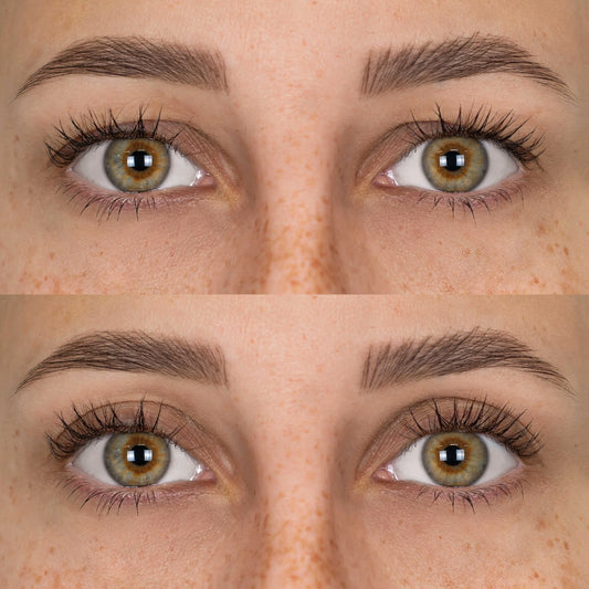 Patchs Lift Paupières